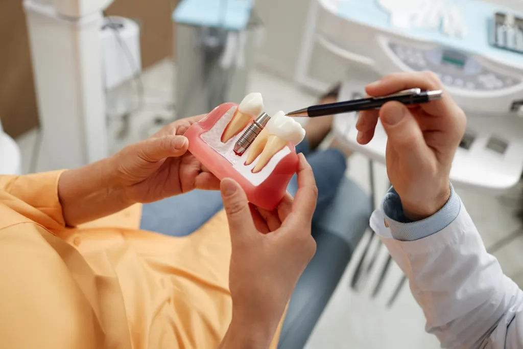 How to Care for Your Dental Implants for Long-Term Success
